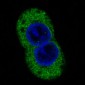Anti-STAT2 Rabbit Monoclonal Antibody
